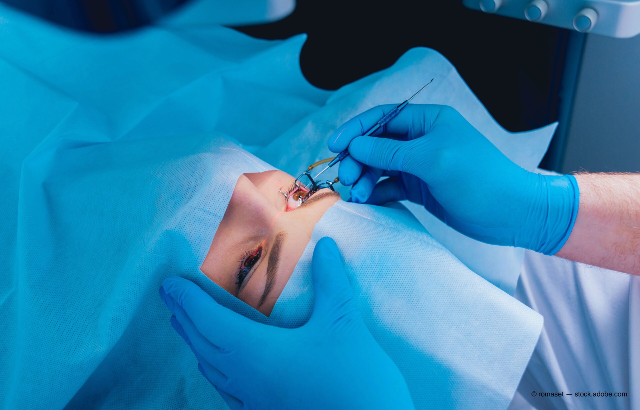 What kind of doctor performs Lasik Surgery?